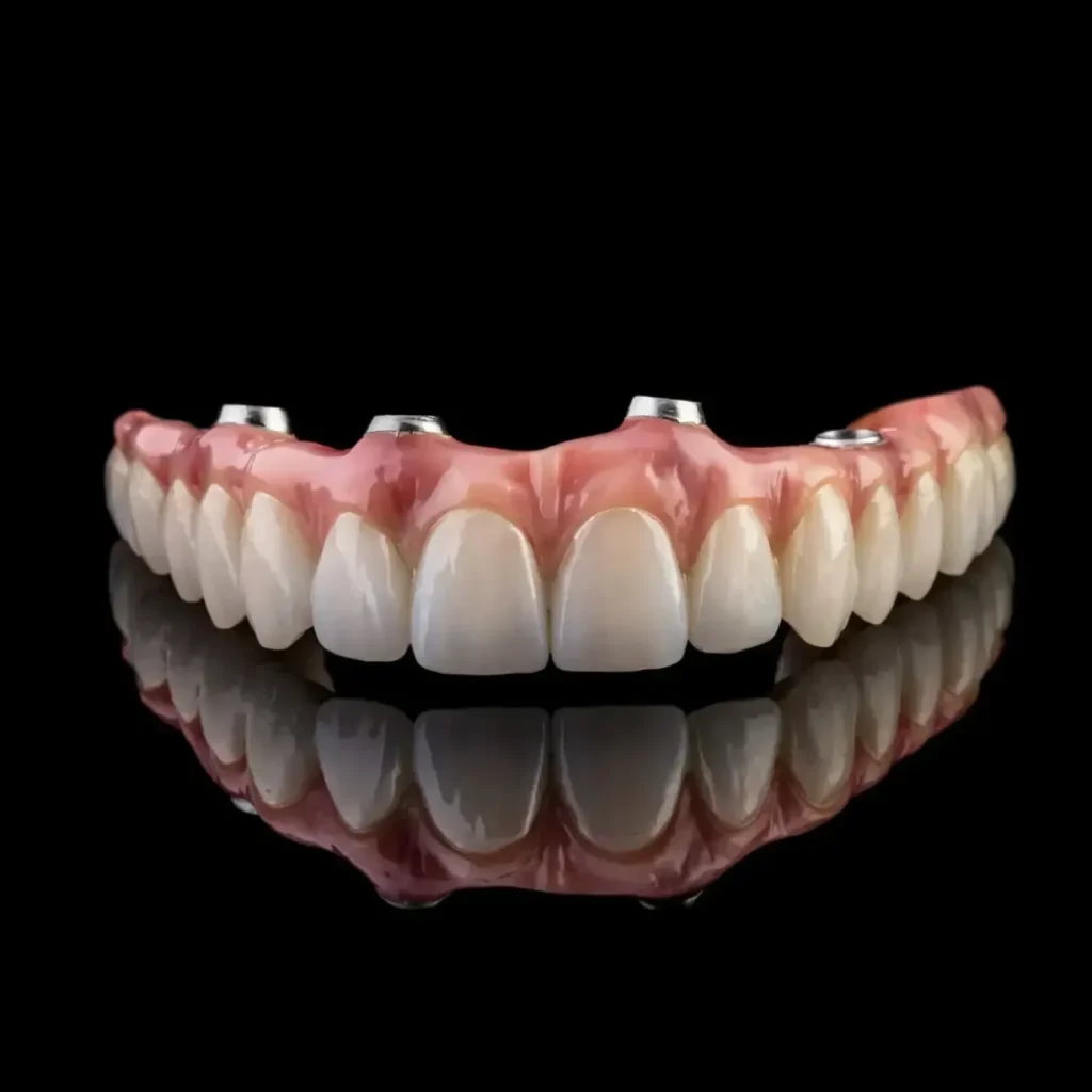 Photo of an all on 4 dental implants bridge